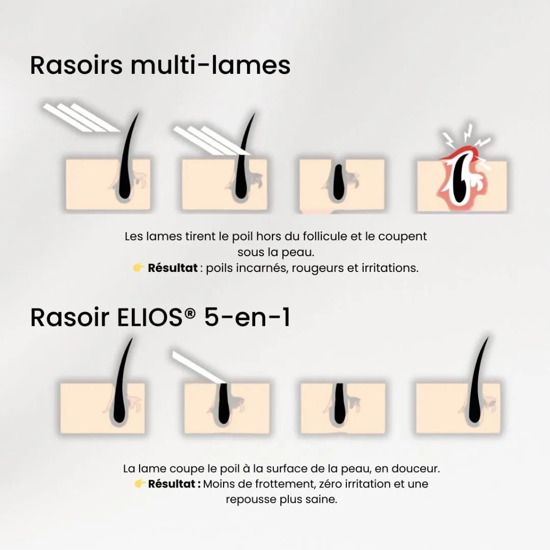 SkinEase™ – Rasoir 5-en-1 pour une Peau Lisse et Douce