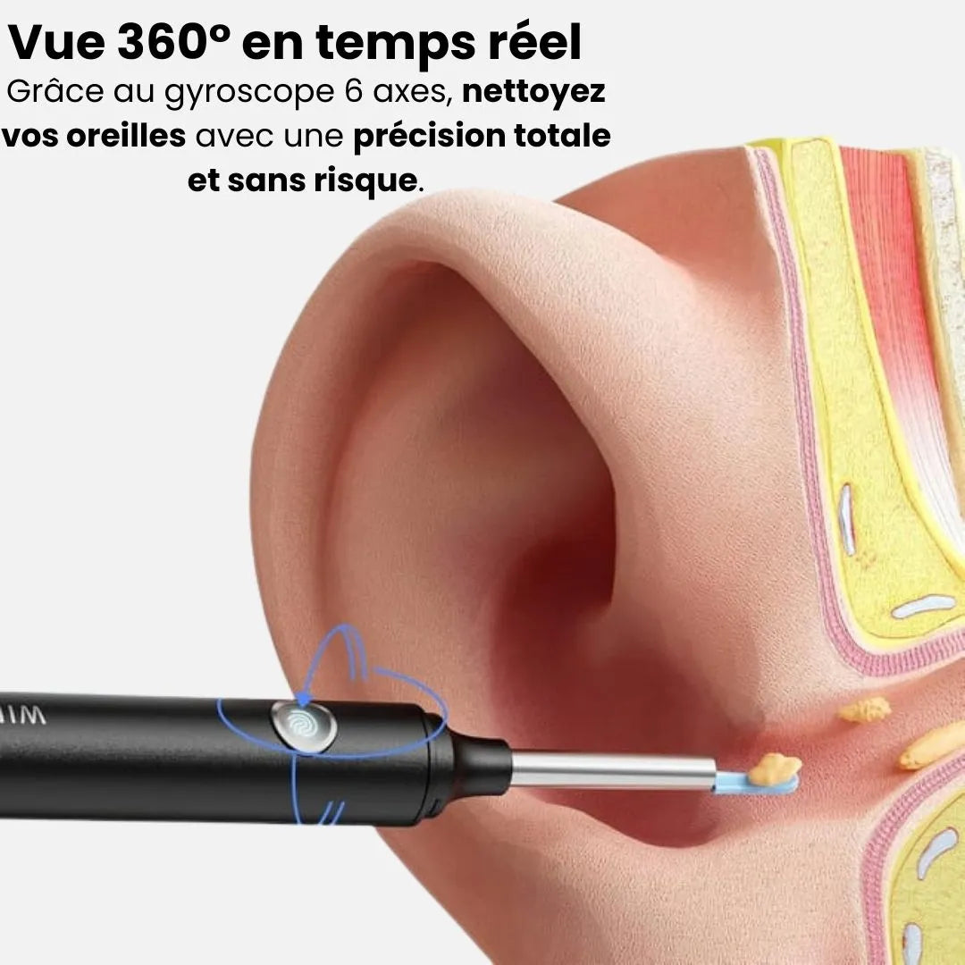 OryaneCam™ – Nettoyeur d’oreilles intelligent avec caméra HD