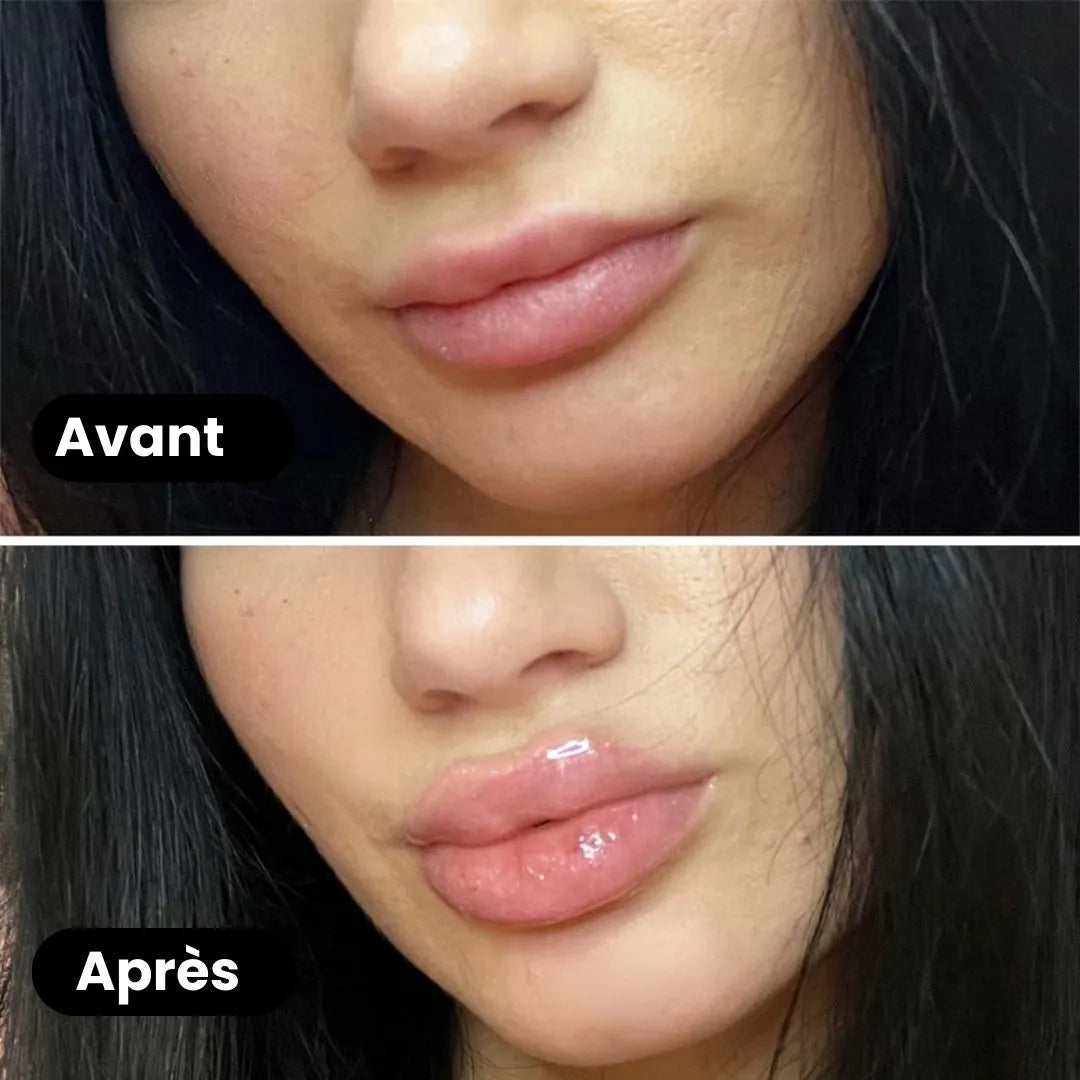 PlumpGloss™ – Des lèvres pulpeuses en 60s