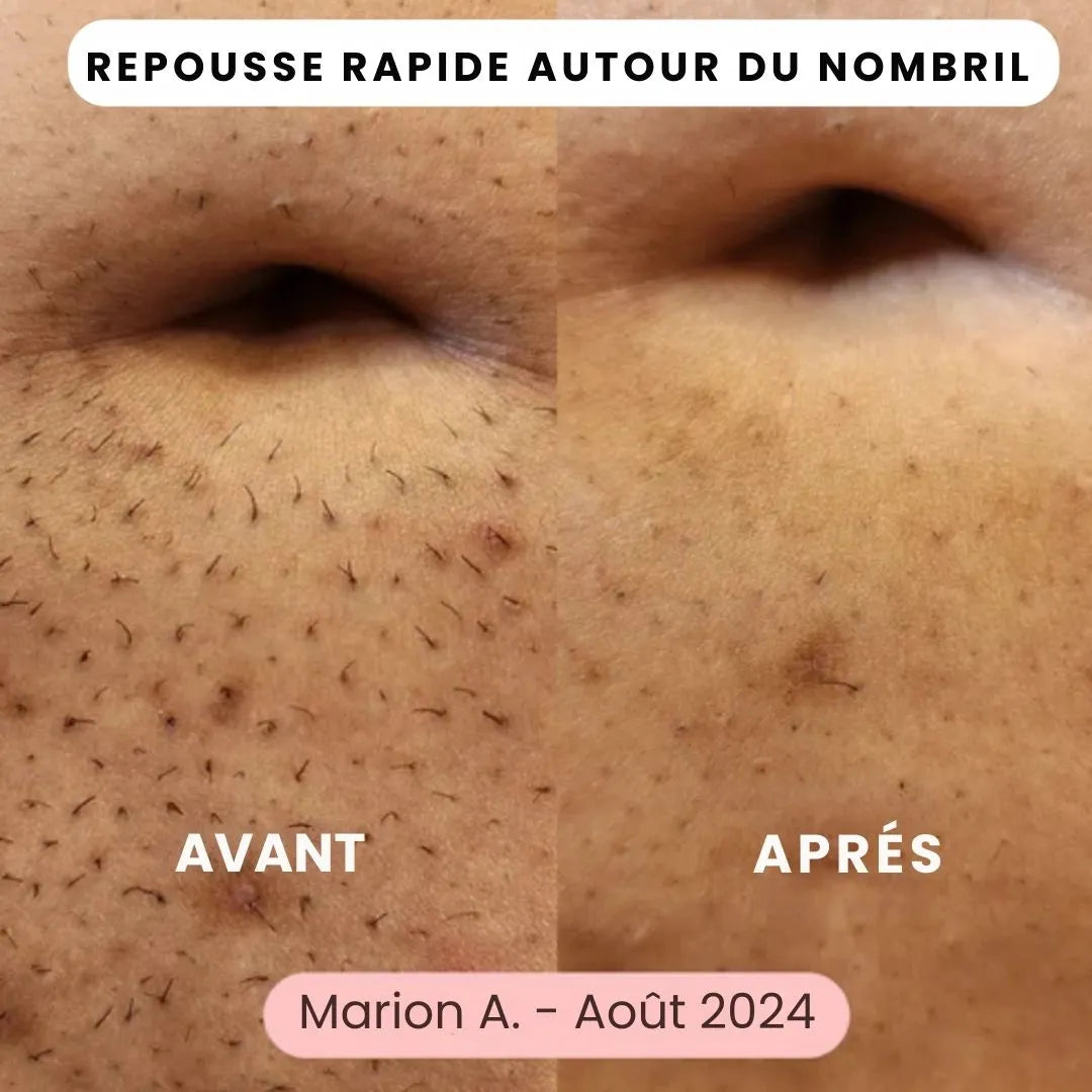 SkinEase™ – Rasoir 5-en-1 pour une Peau Lisse et Douce
