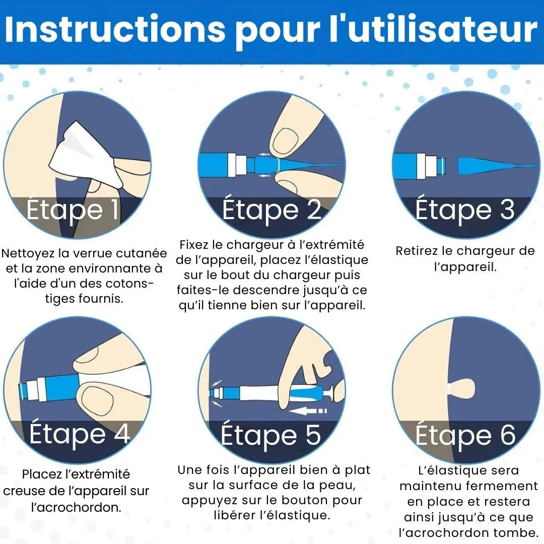 TagBuddy™ – Éliminateur d’acrochordons sans douleur