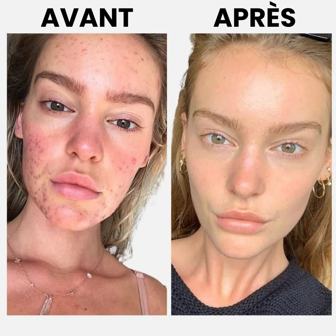 CollagenGlow™ – Masque hydratant & raffermissant intensif