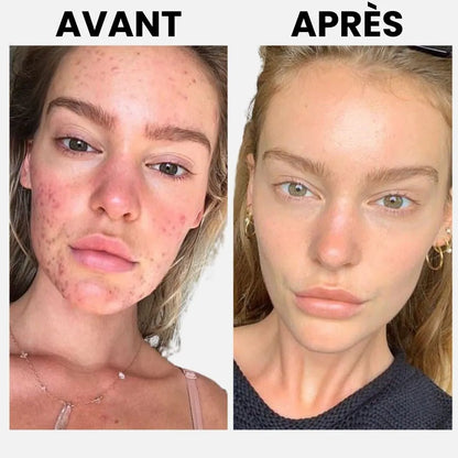 CollagenGlow™ – Masque hydratant & raffermissant intensif