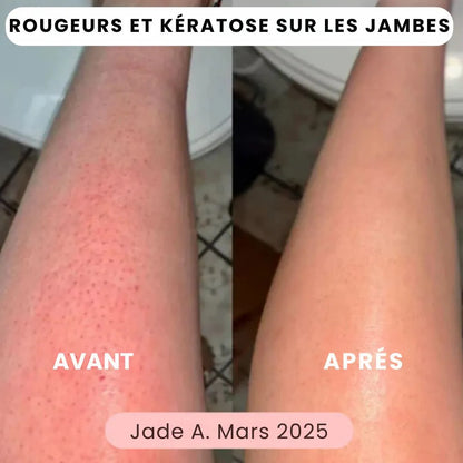 SkinEase™ – Rasoir 5-en-1 pour une Peau Lisse et Douce