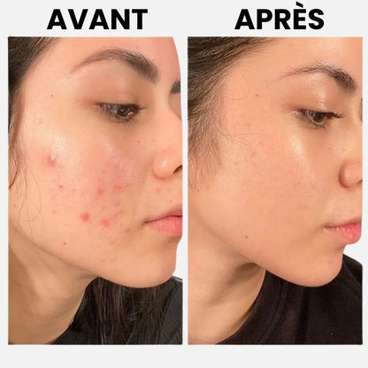 CollagenGlow™ – Masque hydratant & raffermissant intensif