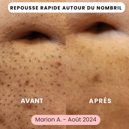 SkinEase™ – Rasoir 5-en-1 pour une Peau Lisse et Douce