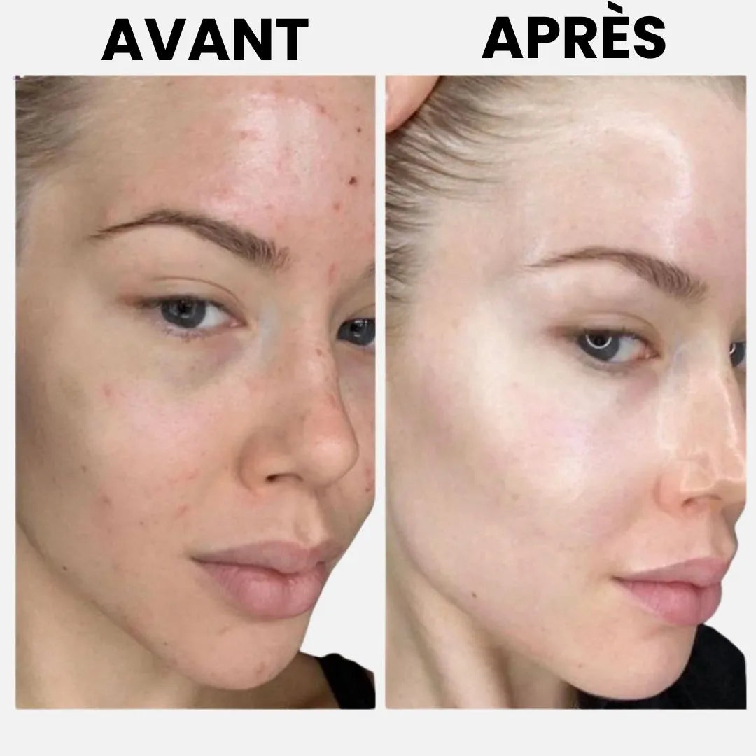 CollagenGlow™ – Masque hydratant & raffermissant intensif