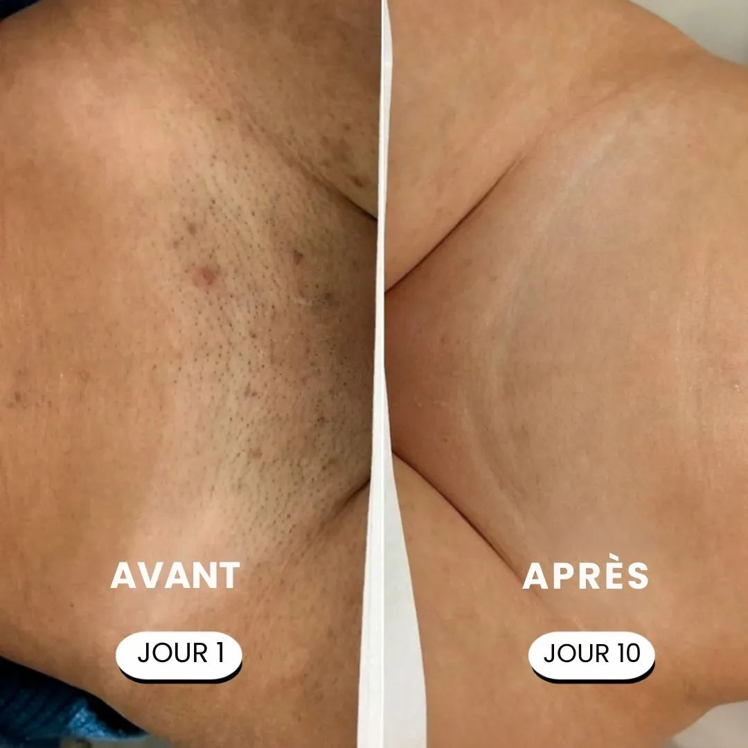 SkinEase™ – Rasoir 5-en-1 pour une Peau Lisse et Douce