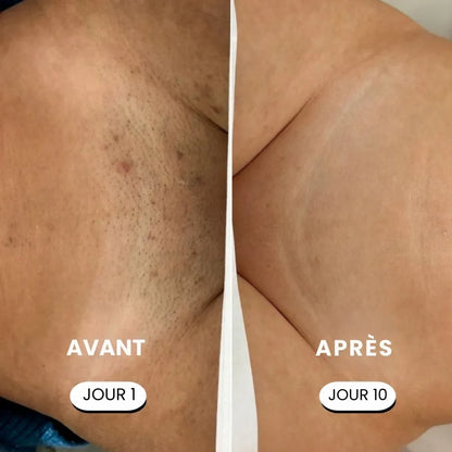 SkinEase™ – Rasoir 5-en-1 pour une Peau Lisse et Douce